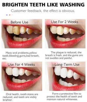 RtopR Zob Čiščenje Zob Mousse 60ml Odstrani Madeže Zob Čiščenje Ustne Higiene Mousse zobna krema Zobne Madeže Zdravo - 